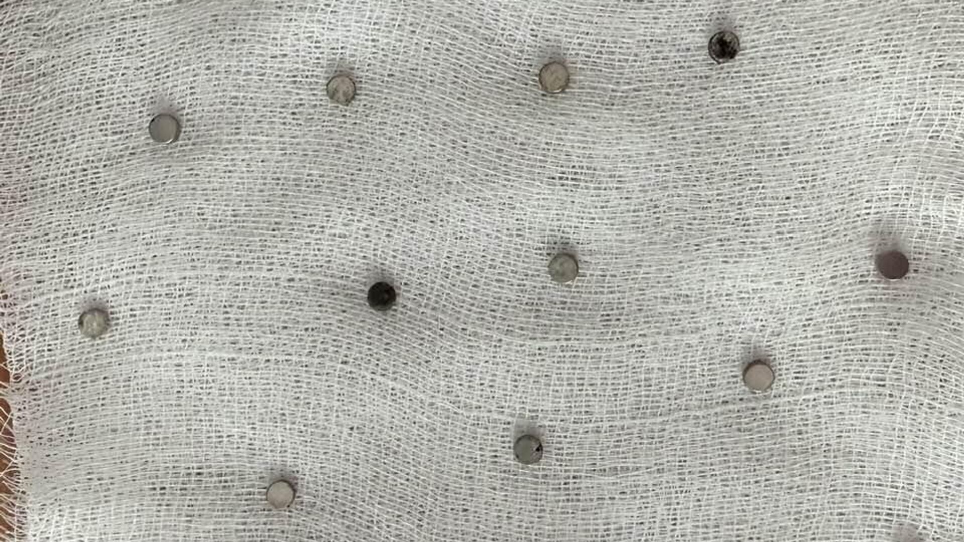 toplam 19 miknatis yemek borusundan cikarildi eNCDIkI6